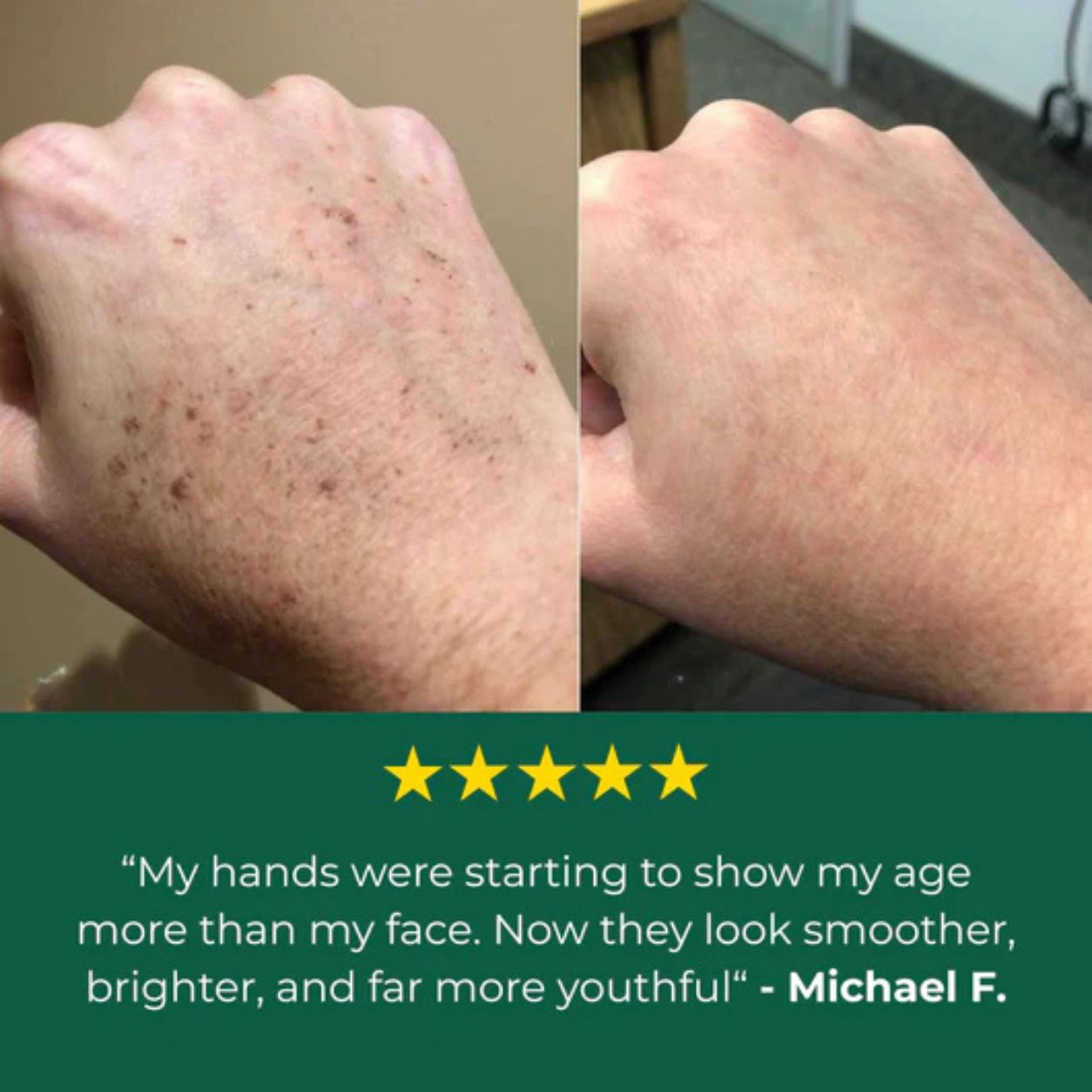 Bloum Age Spot Cream