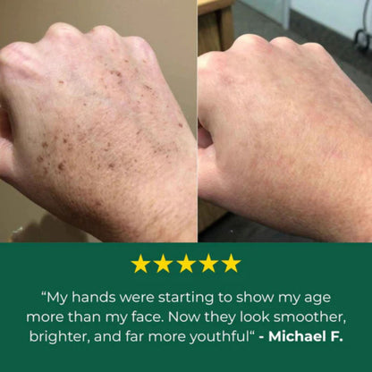 Bloum Age Spot Cream