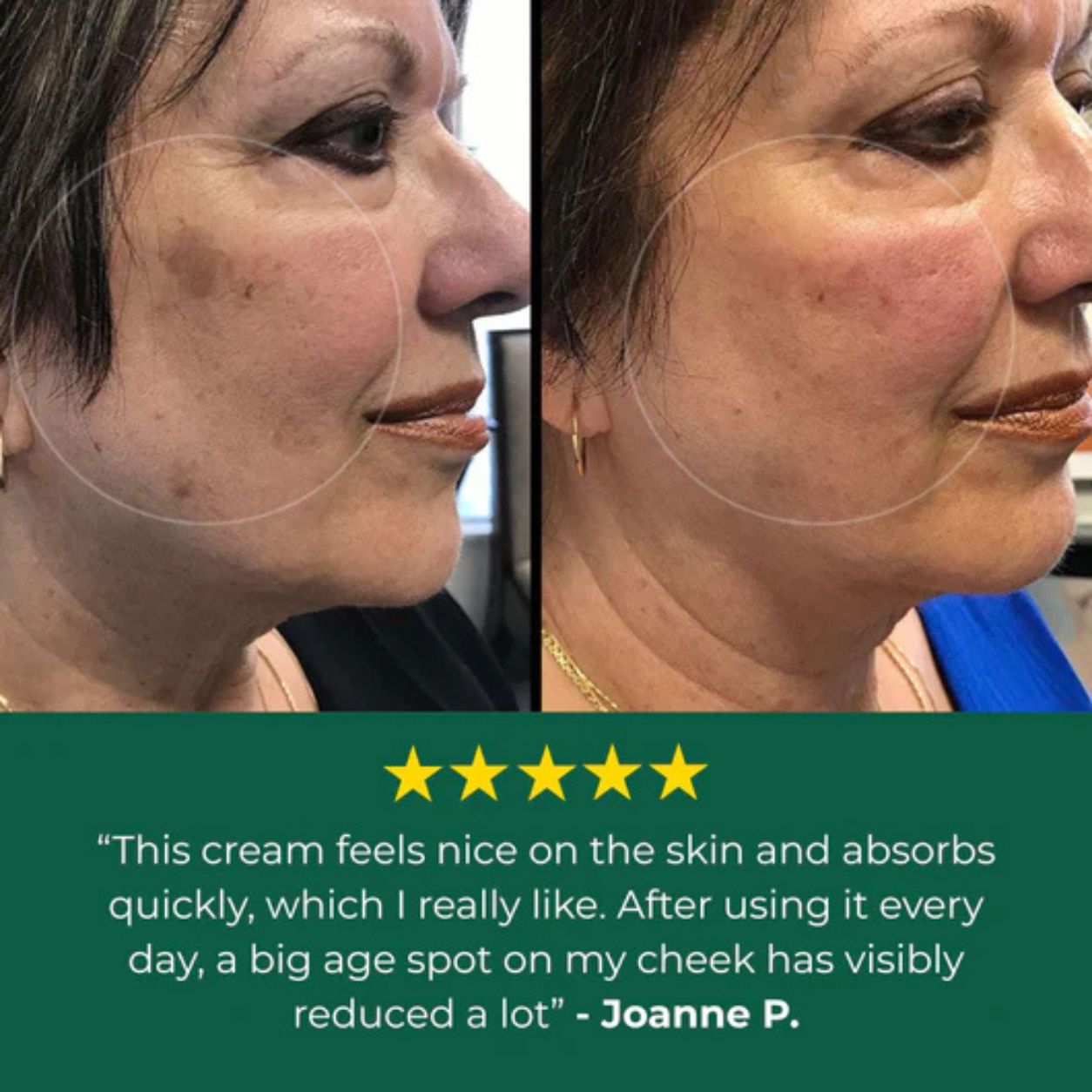 Bloum Age Spot Cream